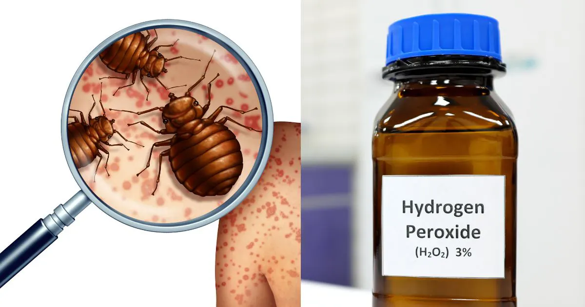Does Hydrogen Peroxide Kill Bed Bugs